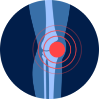 knee